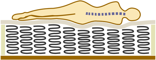 Схематичное
        изображение положения позвоночника человека лежащего на боку на мягком ортопедическом матрасе