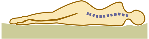 Схематичное изображение позвоночника человека лежащего на жёстком матрасе. Заметно значительное искривление позвоночника, что тем не менее нормально для молодого и здорового тела