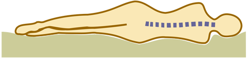 Схематичное изображение позвоночника человека лежащего на мягком матрасе с ортопедическим эффектом. Позвоночник остаётся максимально выпрямленным в поперечной плоскости