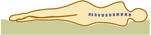 Наиболее естественное положение позвоночника в положении на боку на ортопедическом матрасе